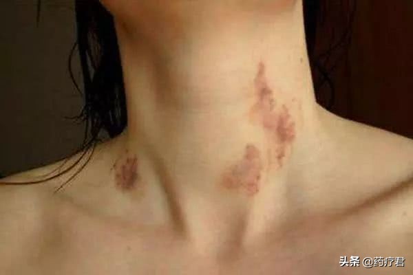 年轻小伙按摩后致死后续,小伙洗浴按摩身亡