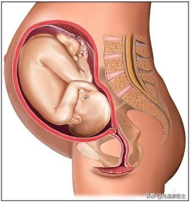 系统性血管炎怀孕能要吗,怀孕得了血管炎怎么办