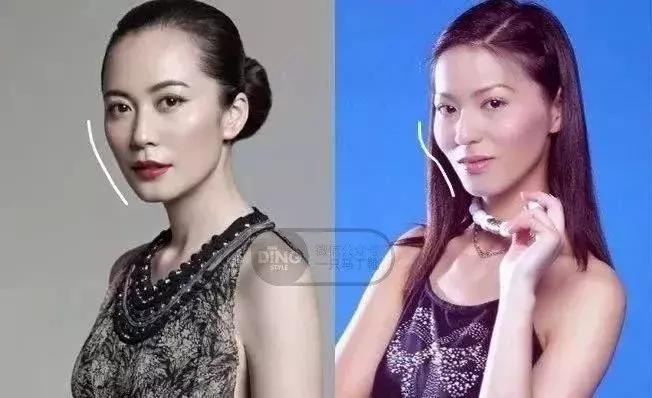 颧骨为什么不能美成俞飞鸿,俞飞鸿颧骨抗老