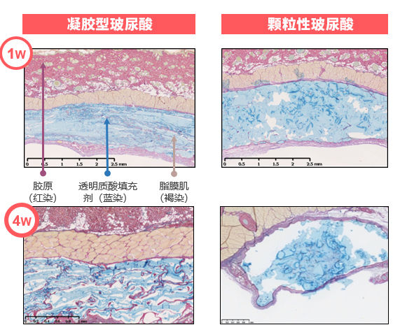 玻尿酸比较好的,好的玻尿酸成分表