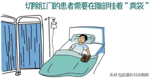 为什么医生一般建议切除痔疮,医生为什么要切除扁桃体