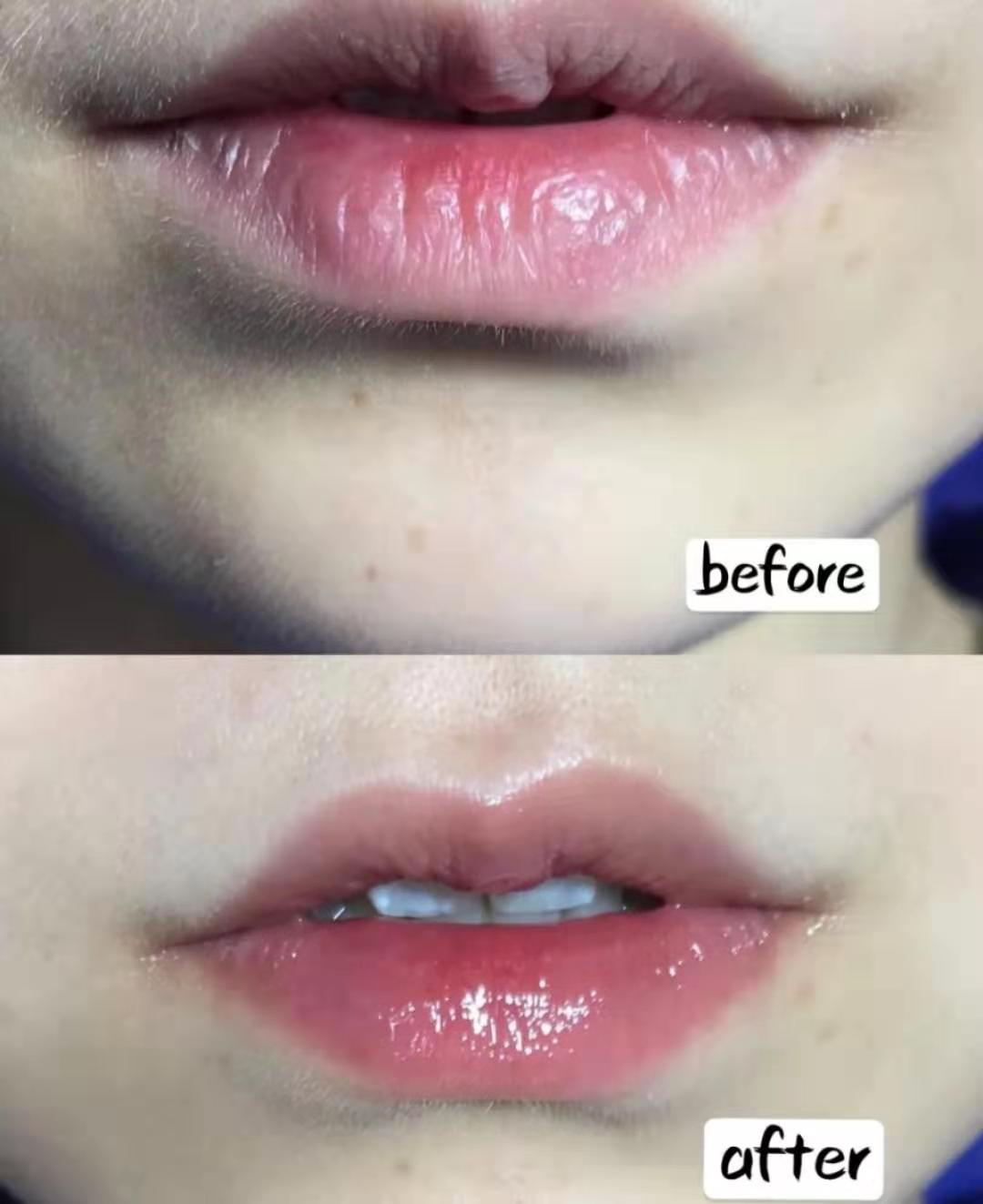 嘴巴干裂起皮推荐护唇油,秋冬季嘴唇干裂起皮这样涂