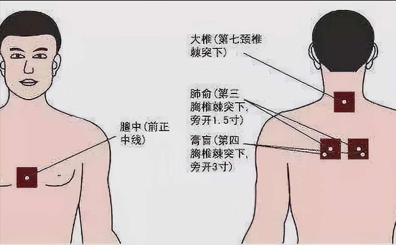 中医治疗哮喘有哪些优势,哮喘中医真的治得好吗