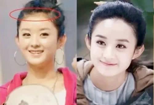 额头窄怎么办适合什么刘海,额头窄不好看怎么办