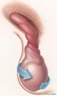 泌尿外科那点事儿公众号,泌尿外科那些事儿