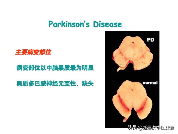 中枢神经系统断层解剖讲解,中枢神经3d解剖动画