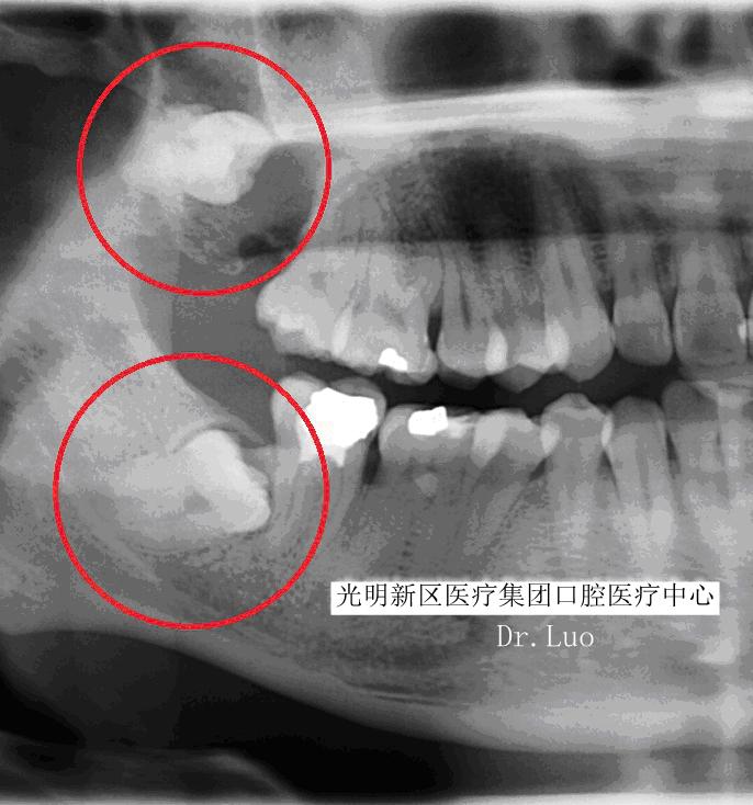牙科诊所里你不知道的事,口腔医生提醒