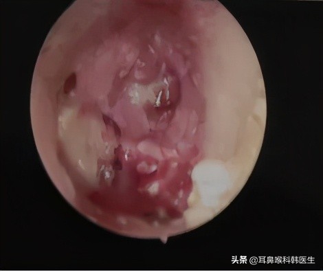 为啥来院就做内镜检查?医生怕是在骗我钱吧