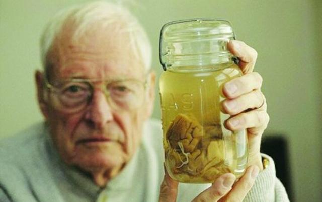 普通人大脑和爱因斯坦的大脑,爱因斯坦大脑与普通人大脑的区别