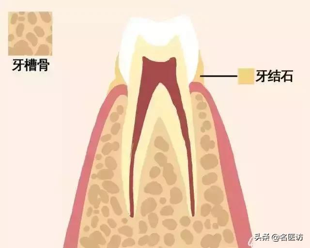 牙齿如何正确的脱落,一张动图告诉你