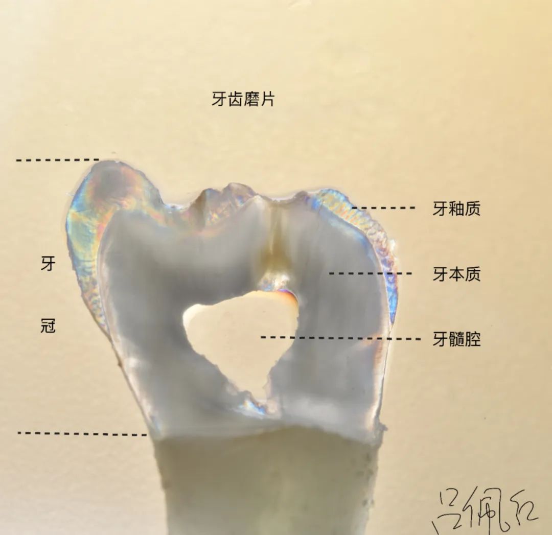 美白牙膏去牙黄真实有效测评,美白牙膏真实测评护牙效果