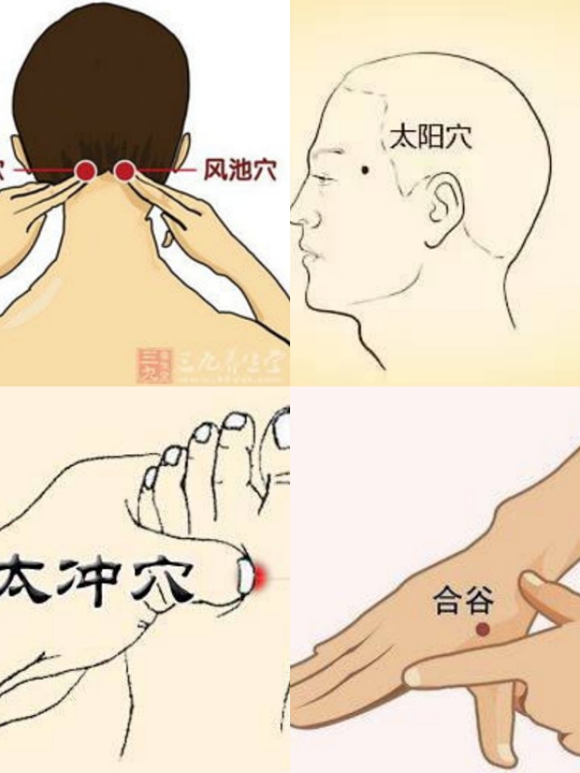 北京于书庄针刺风池合谷太冲头维并太阳放血治血管扩张性头痛案