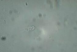 收藏!24种污水处理微生物菌相及指导意义,环保人必看(多图)