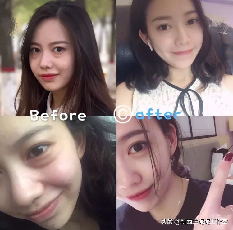 吴昕同款祛黄脸,吴昕眼袋