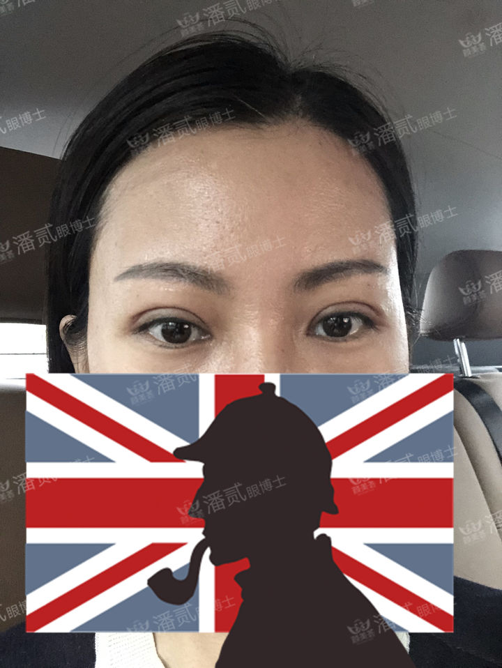 原来双眼皮不好看有必要继续割吗,割双眼皮是不是越修复越难看