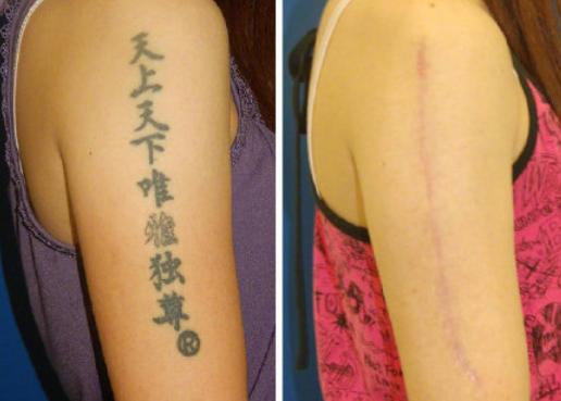 分手了情侣纹身怎么弄,分手了纹身怎么处理