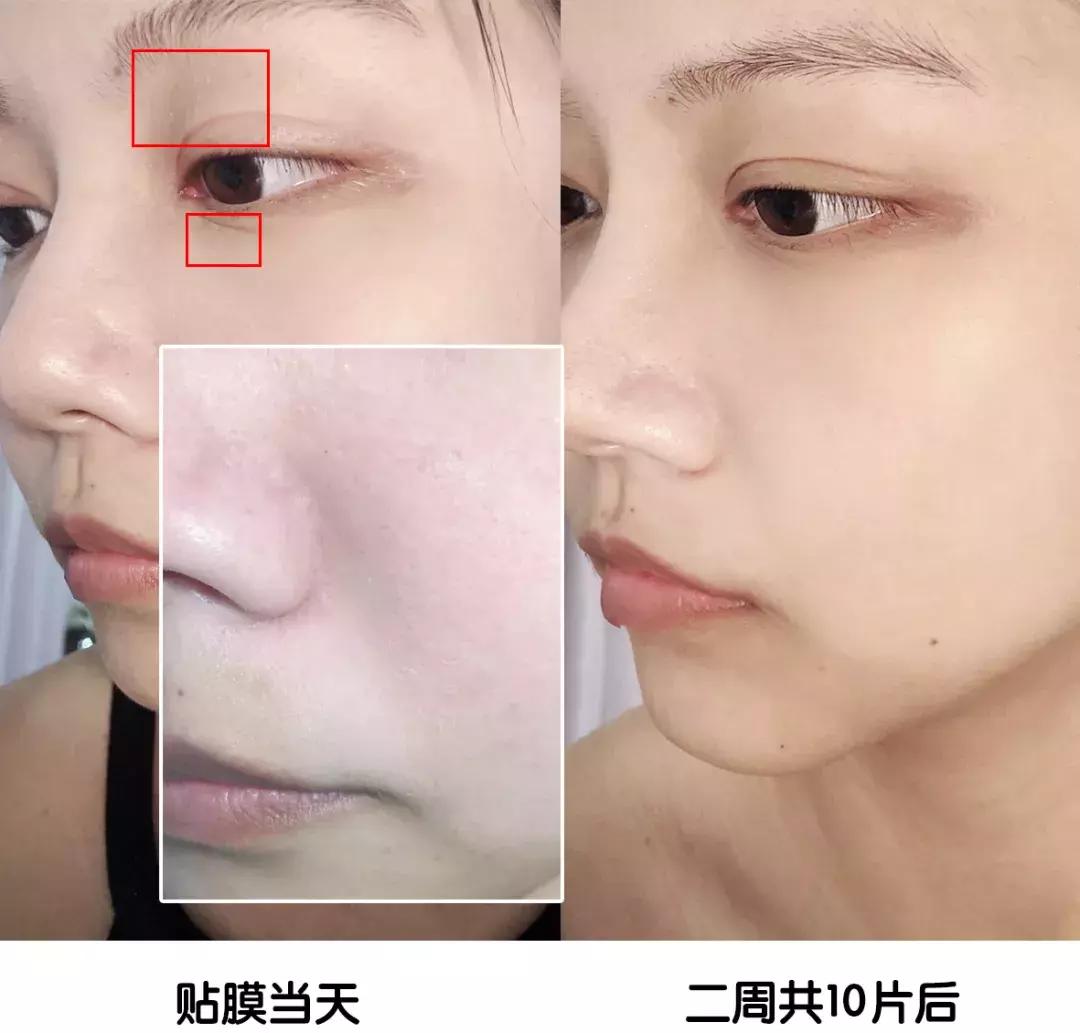 不要被面膜骗了,千万别被美容院忽悠