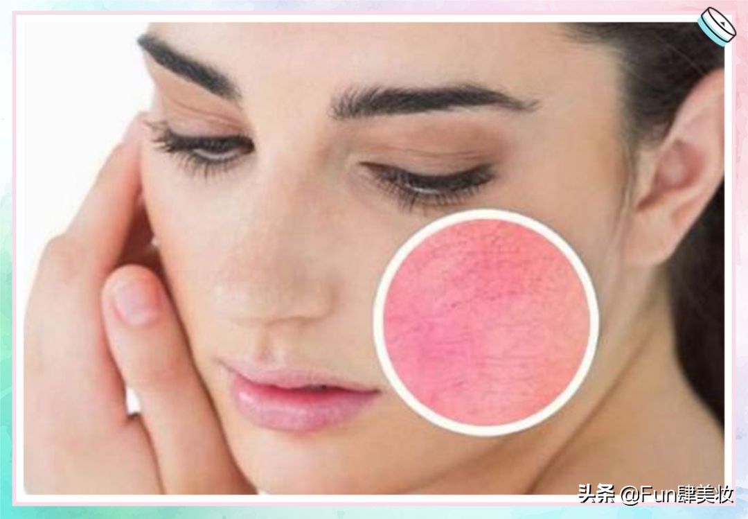 皮肤不好都是后天形成的,皮肤不好的各种原因