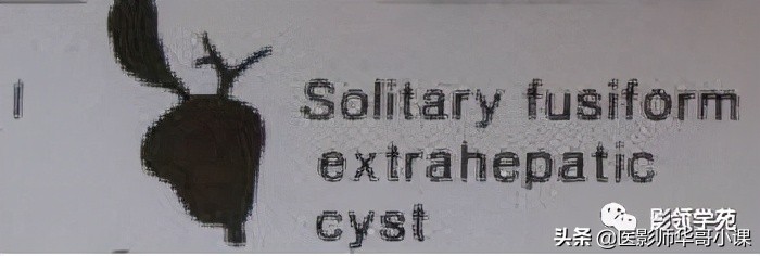 胆总管变异,胆胰管解剖