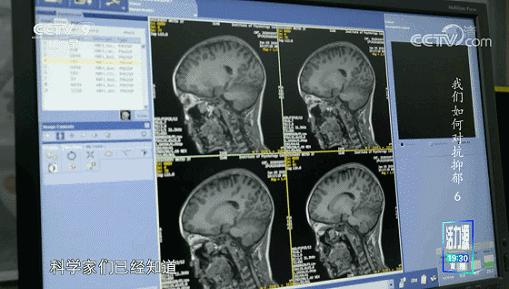 每30秒就有一个人自杀，求求别再叫她们想开点了