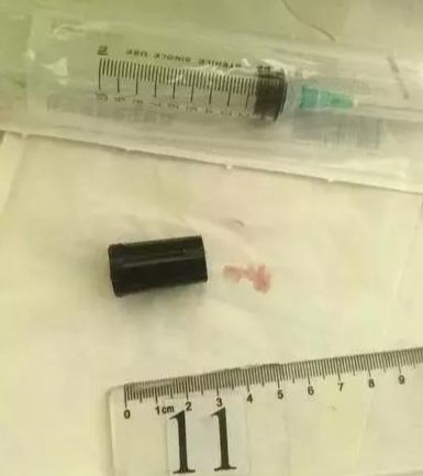 打火机在手里爆了怎么办,打火机咬爆了会崩嘴吗