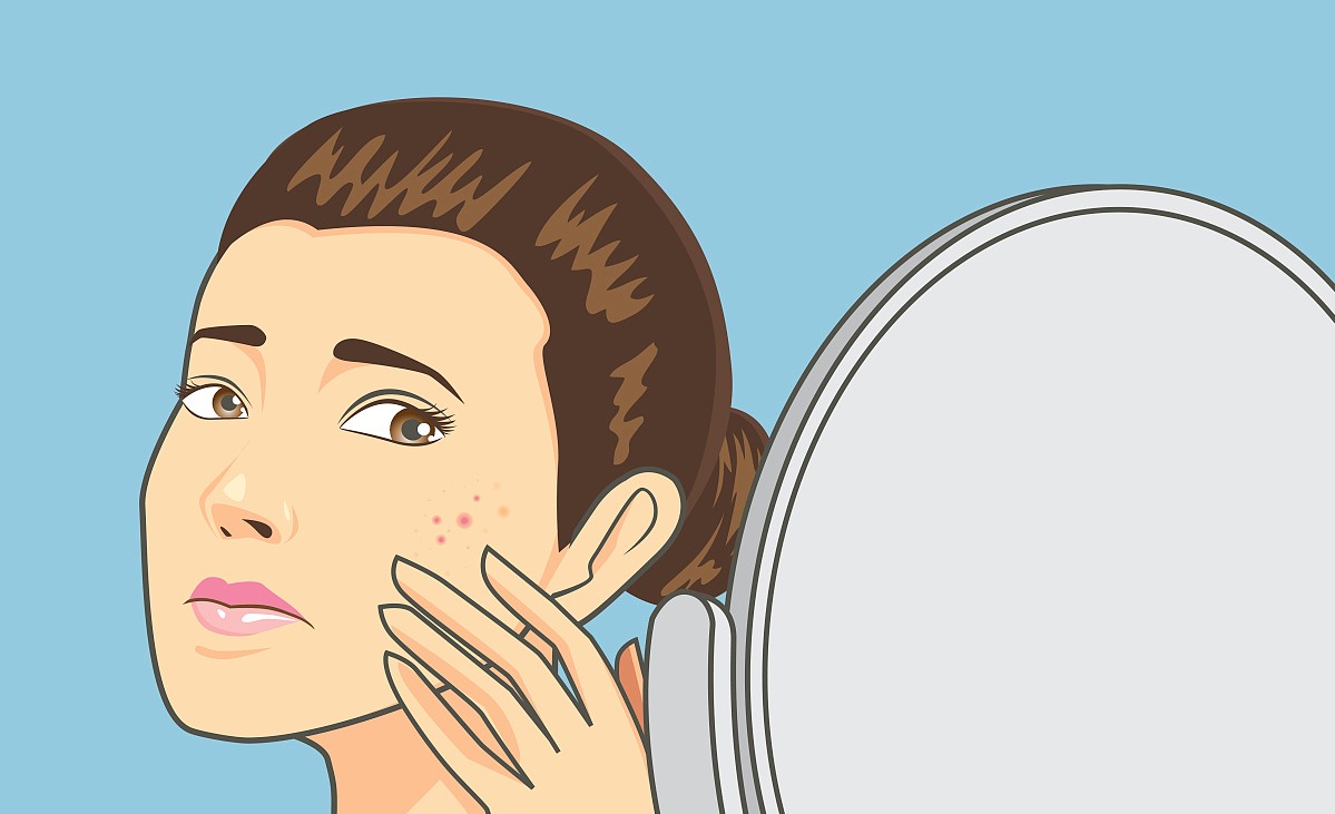 激素依赖性皮炎西医能治好吗,激素药导致皮肤毛细血管扩张