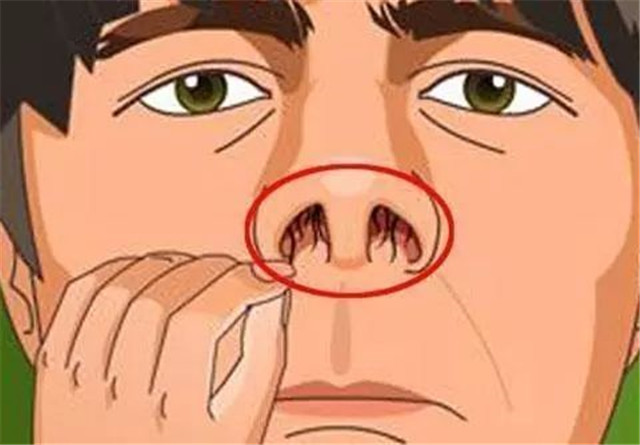 男性鼻毛长出来意味着什么,男士鼻毛窜出来鼻毛旺盛说明什么