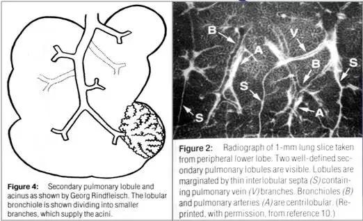 肺部ct十大征象,肺部ct正常图和异常图的区别