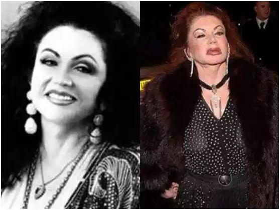 整容后老了会怎样知乎,整容过后老了是不是会更丑