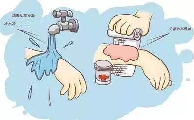 烧伤烫伤自救,烧伤后应急措施