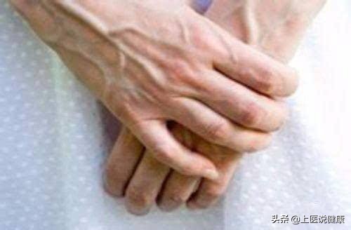 身体上出现的青筋是怎么回事,身体上的青筋明显是怎么回事