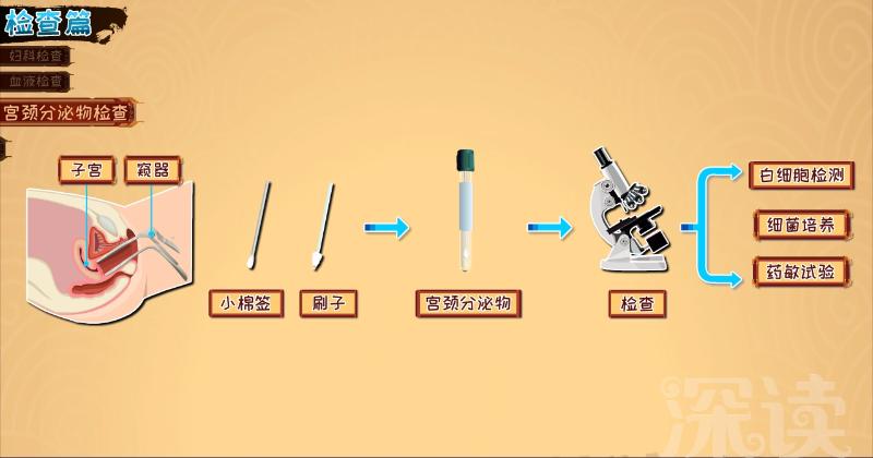 子宫内膜炎要治多久?治疗期间能啪吗?该注意啥?硬核科普