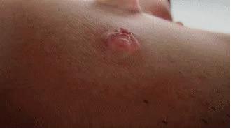 超好用的祛痘膏便宜,有没有好用的祛痘膏推荐女孩子