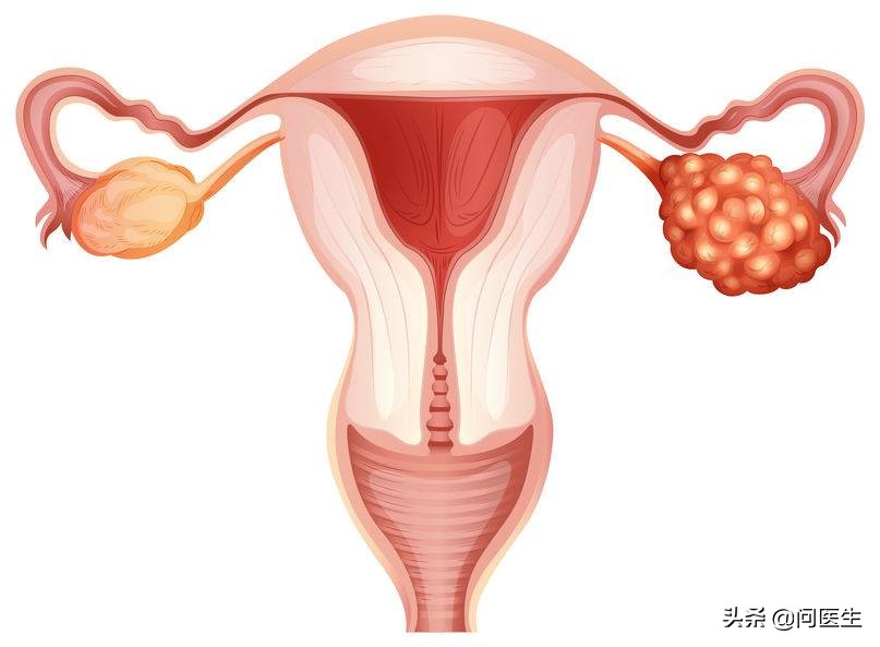 90后姑娘同房后血崩？注意：月经周期后期剧烈运动易黄体破裂