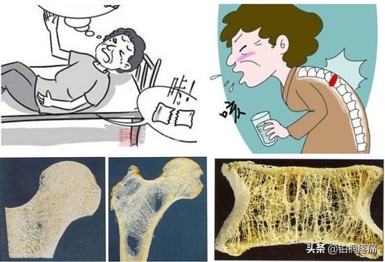 女人膝盖疼痛警惕四种病因,膝盖内侧疼痛的病因