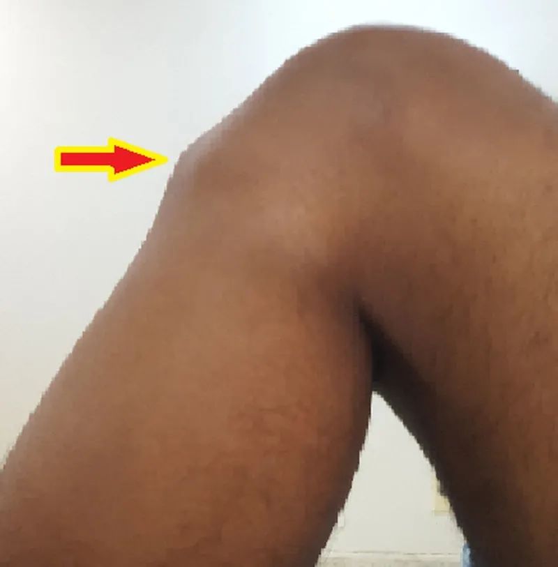 13岁一天跳绳1000个可以长高吗,14岁长高跳绳每天跳几下