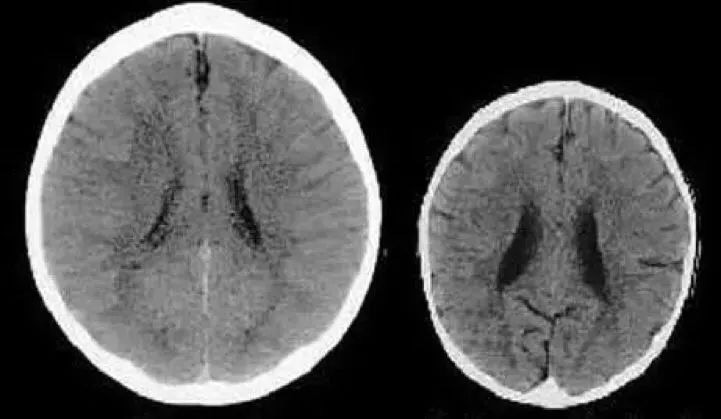 怎么控制对孩子发火,如何控制情绪打孩子
