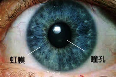 强直性脊柱炎会引起眼结膜充血,强直性脊柱炎眼炎属于什么阶段