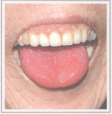 从舌头看身体状况拍照,如何看舌头判断孩子身体状况