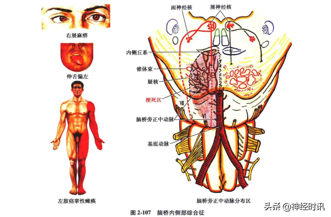 脑干解剖,脑干神经解剖