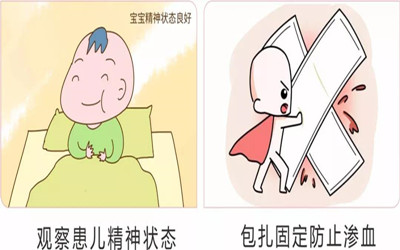 血管瘤破溃出血的预防和处理措施,血管瘤反复出血怎么办