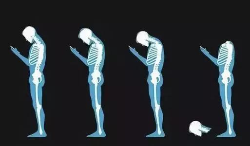 9岁小学生颈椎弧度变直,九岁颈椎变直