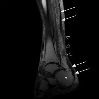杜兰特和汤普森受伤视频,伤病猛于虎是什么意思
