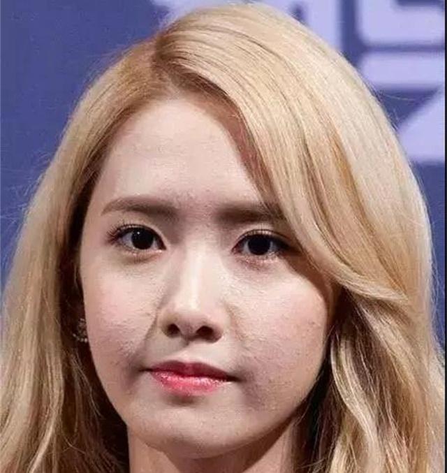 长闭口粉刺不用管它会自动消失，是真的吗？其实是你太天真了