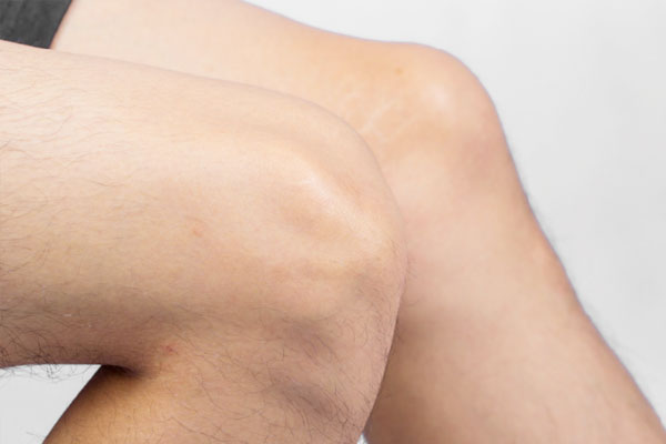 骨质疏松为什么治不好,骨质疏松为什么难防又难治