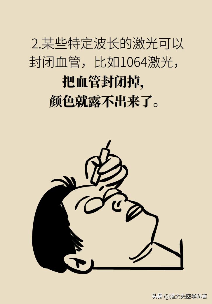 医生黑眼圈,手术消除黑眼圈靠谱吗