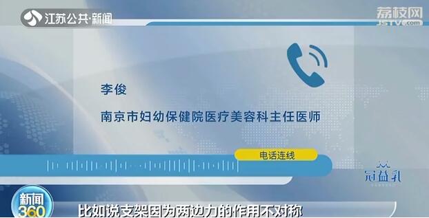 女子隆鼻拆夹板歪了,施尔美整形医院鼻综合