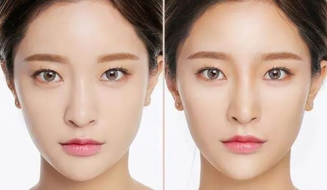 鼻子宽怎么变小一点,鼻子又宽又大怎么变小