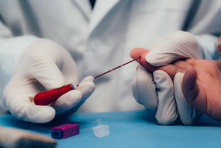 乙肝45项为阳性还用吃抗病毒药吗,体检乙肝45阳会是假阳性吗