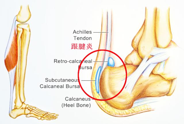 足跟疼痛教你一招百试百灵,早起落地脚疼